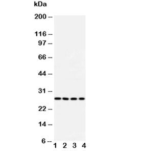 Western blot testing of Bcl10 antibody and Lane 1: U87; 2: MCF-7; 3: HeLa; 4: COLO320 cell lysate. O