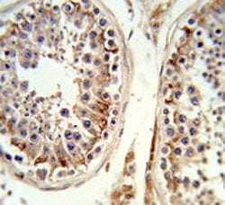 Integrin beta 3 Antibody (ITGB3)