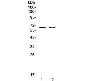 Western blot testing of 1) human placenta and 2) mouse testis lysate with RUNX1T1 antibody at 0.5ug/