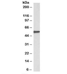 Western blot testing of human kidney lysate with EPHX2 antibody at 0.3ug/ml. Predicted molecular wei
