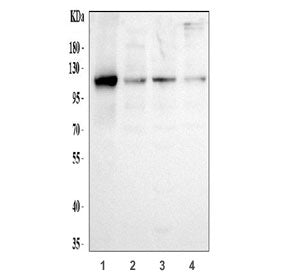 Hexokinase 2 Antibody