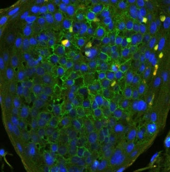 CD44 Antibody