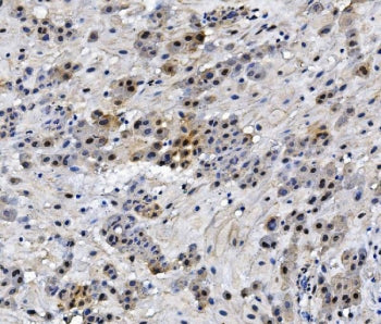 IHC staining of FFPE human placenta with HMGB3 antibody. HIER: boil tissue sections in pH8 EDTA for 