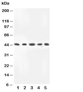 Western blot testing of MKK4 antibody and Lane 1: rat skeletal muscle; 2: HeLa; 3: A549; 4: MM231; 5