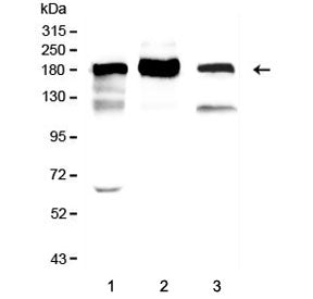 ACE Antibody
