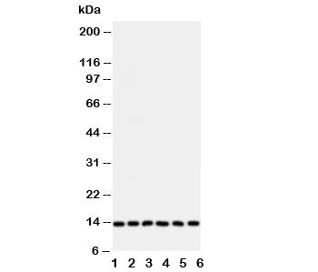 Western blot testing of Glutaredoxin 2 antibody and Lane 1: rat testis; and human samples 2: HeLa; 3