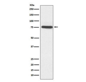 Western blot testing of human HeLa cell lysate with TAK1 antibody. Predicted molecular weight: 64-69