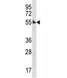 Cyclin A antibody western blot analysis in mouse kidney tissue lysate. Predicted molecular weight: 5