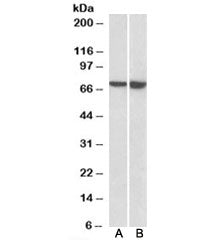 Western blot testing of Daudi [A] and U937 [B] lysates with L-Plastin antibody at 0.5ug/ml. Predicte
