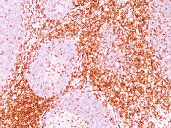 IHC staining of FFPE human tonsil tissue with CD6 antibody (clone 3F7B5). HIER: boil tissue sections