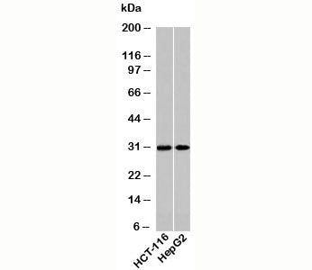Western blot testing of human samples using HOXA9 antibody at 2ug/ml. Expected/observed molecular we