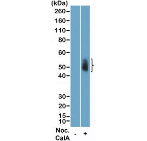 Western blot testing of lysate of human HeLa cells, non-treated (-) or treated (+) with Nocodazole a
