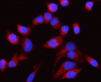 Immunofluorescent staining of FFPE human HeLa cells with CP110 antibody (red) and DAPI nuclear stain
