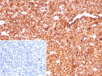 IHC staining of FFPE human tonsil tissue with CD45RA antibody (clone PTPRC/8699R). Inset: PBS used i