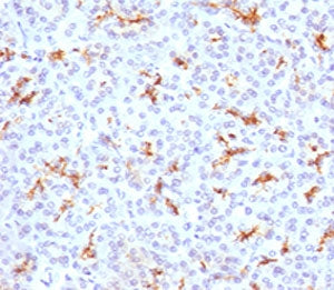 IHC testing of FFPE human pancreas with CFTR antibody (clone CFTR1-1). Staining of FFPE tissue is en