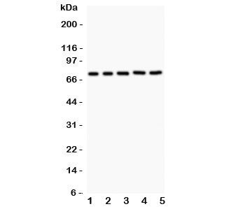 Western blot testing of RIP1 antibody and Lane 1: Jurkat; 2: 22RV1; 3: MCF-7; 4: HeLa; 5: A549. Expe
