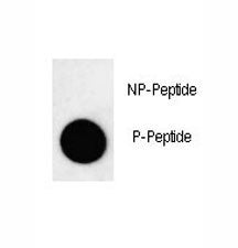 Phospho-LC3B Antibody (pT29)