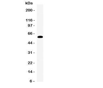 EAAT3 Antibody