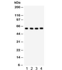 HRPT2 Antibody / CDC73