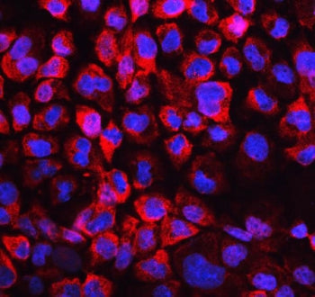 LDHB Antibody / Lactate dehydrogenase B
