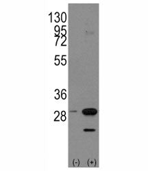 Western blot analysis of PHB antibody and 293 cell lysate either nontransfected (Lane 1) or transien