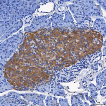 SEL1L Antibody / Suppressor of lin-12-like protein 1