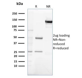SDS-PAGE analysis of purified, BSA-free Gastrin antibody (clone GAST/2632) as confirmation of integr
