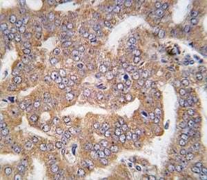 PAK4 Antibody