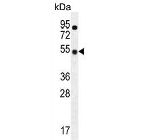 Western blot testing of human CCRF-CEM cell lysate with TBC1D13 antibody. Predicted molecular weight