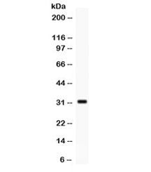 Western blot testing of human MCF7 cell lysate with SNAI3 antibody. Expected/observed molecular weig