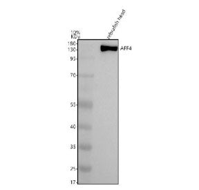 Western blot analysis of Aff4 protein using Zebrafish Aff4 antibody and zebrafish head tissue lysate
