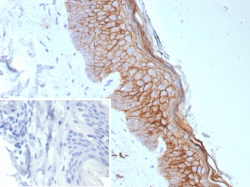 IHC staining of FFPE human skin tissue with recombinant S100A14 antibody (clone S100A14/9077R). Inse