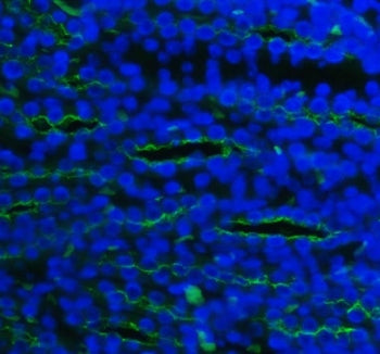 NKCC2 Antibody / SLC12A1