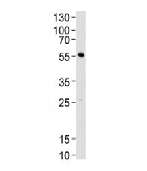 Western blot analysis of mouse thymus tissue lysate using Lck antibody at 1:1000. Predicted molecula