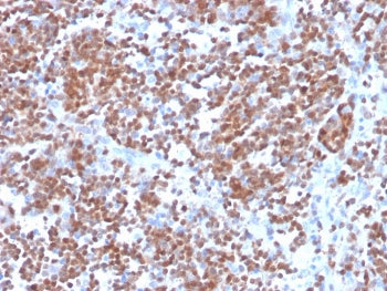 Cyclin D1 Antibody / CCND1