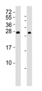 RHOXF1 Antibody
