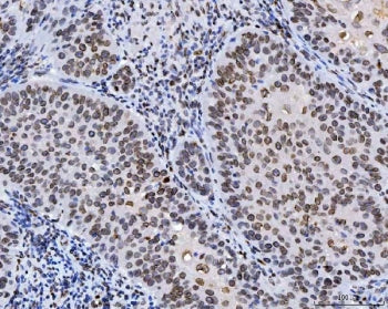 Lamin A/C Antibody