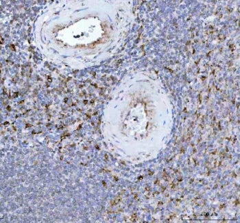 IHC staining of FFPE human spleen tissue with Heme Oxygenase 1 antibody. HIER: boil tissue sections 