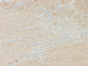 SMMHC Antibody / Smooth Muscle Myosin Heavy Chain