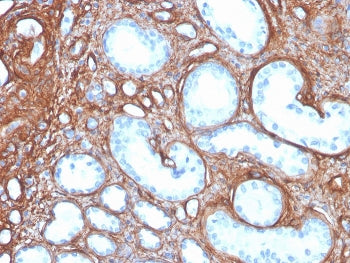 Collagen IV Antibody / COL4A