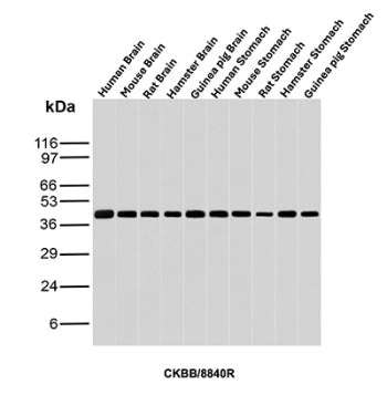 Western blot analysis of Human Brain, Mouse Brain, Rat Brain, Hamster Brain, Guinea pig Brain, Human
