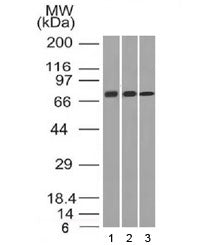 Western blot testing of human 1) HeLa, 2) A431 and 3) HL60 cell lysate with CD105 antibody (clone EN