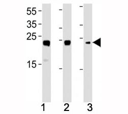 HMGB2 antibody western blot analysis in (1) HL-60, (2) K562, (3) H-4-II-E lysate. Expected molecular