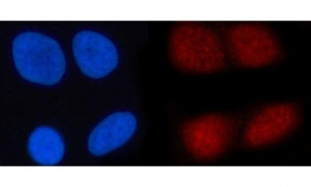 Immunofluorescent staining of FFPE human HeLa cells with N4BP1 antibody (red) and DAPI nuclear stain