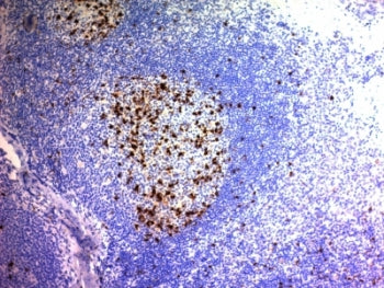 CD57 / HNK-1 Antibody