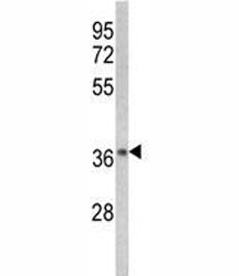 IkB alpha Antibody