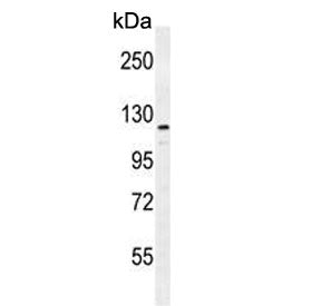 Western blot testing of human MDA-MB-231 cell lysate with ADAMTS18 antibody. Predicted molecular wei