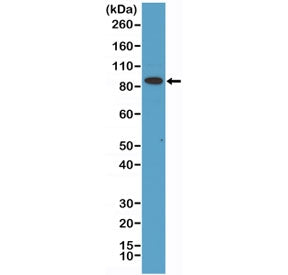 Western blot testing of human HeLa cell lysate with recombinant Transferrin Receptor antibody at 1:1