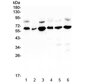Western blot testing of human 1) U-87 MG, 2) A431, 3) HL-60, 4) K562, 5) ThP-1 and 6) HeLa lysate wi