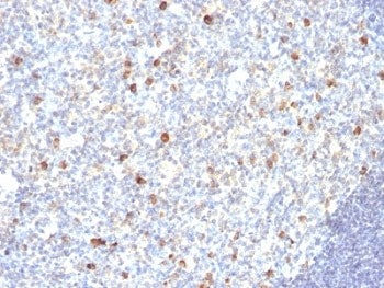 IgM Heavy Chain Antibody